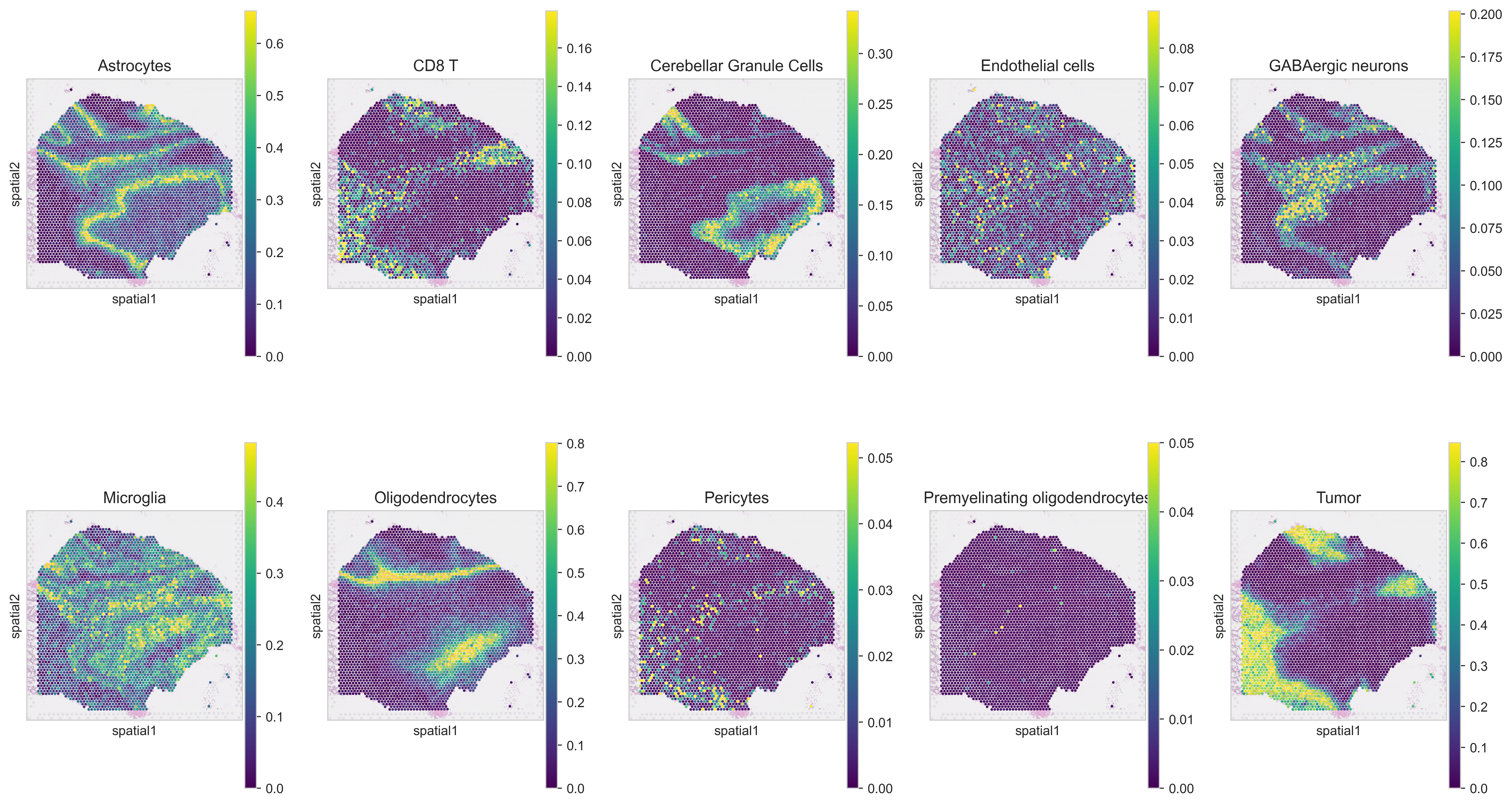 _images/Spotiphy_tutorial_2_HumanBrain_33_0.png