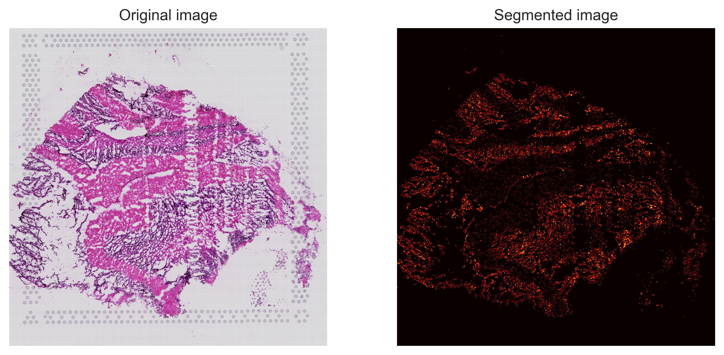 _images/Spotiphy_tutorial_2_HumanBrain_37_0.png